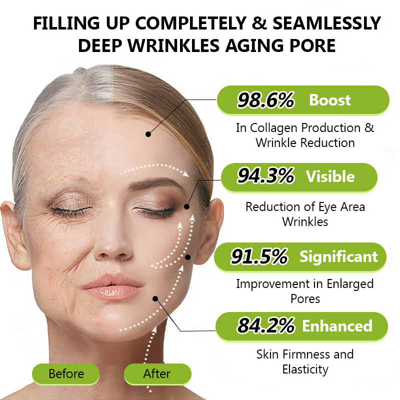 𝑶𝒇𝒇𝒊𝒄𝒊𝒂𝒍 𝑺𝒕𝒐𝒓𝒆👍| Regain youthful skin nown 💫STDEI® BOTOX & VITA A RETINOL SHOT Wrinkle Lift Tightening Cream