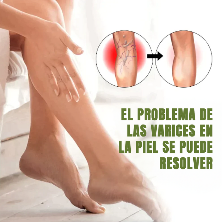 MEDix™ Lenisce le vene Max