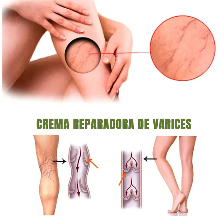 MEDix™ Lenisce le vene Max